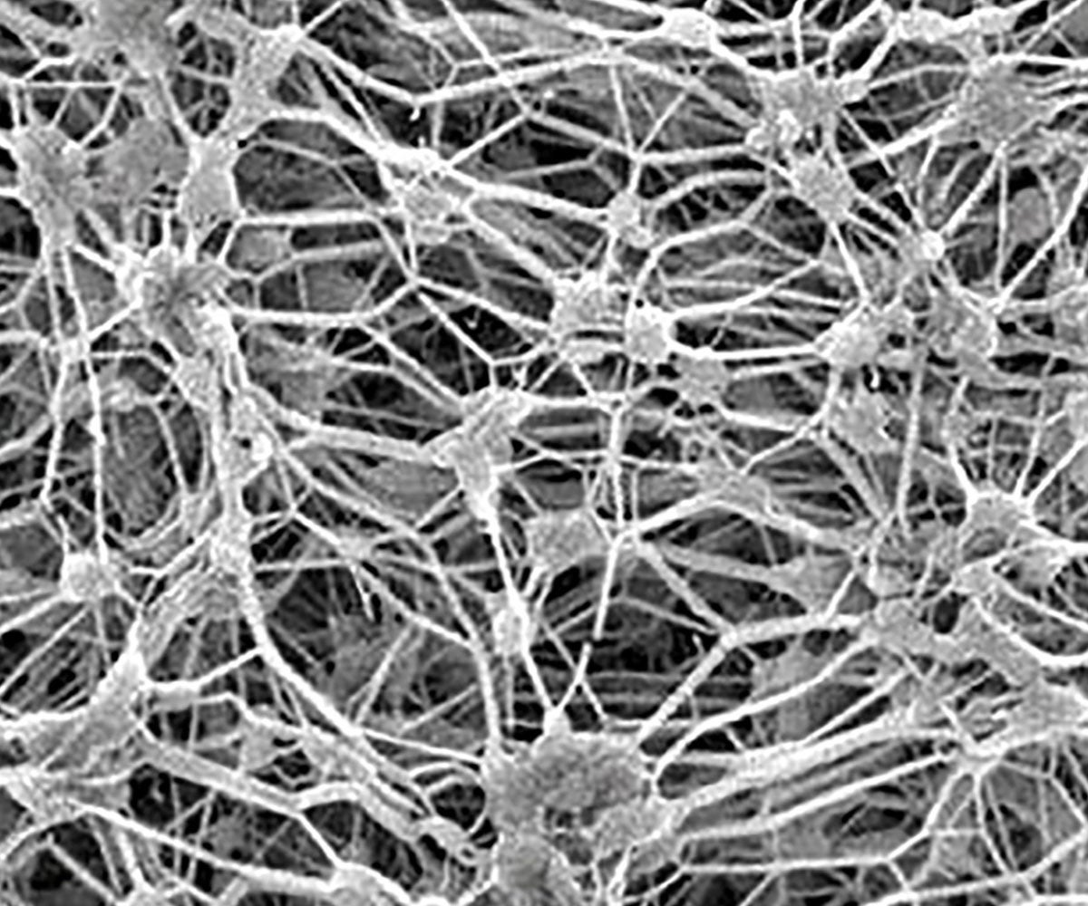 Expanded polytetrafluoroethylene